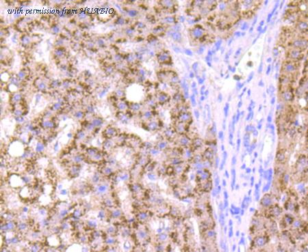 HUABIO ET1704-03 image 2