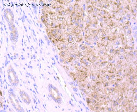 HUABIO ET1704-03 image 3