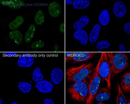HUABIO ET1704-05 image 2