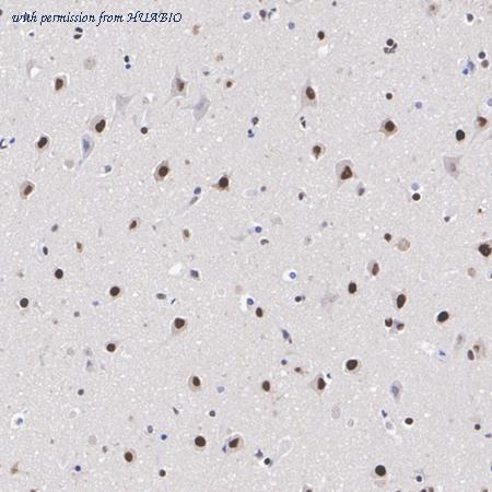 HUABIO ET1704-05 image 3