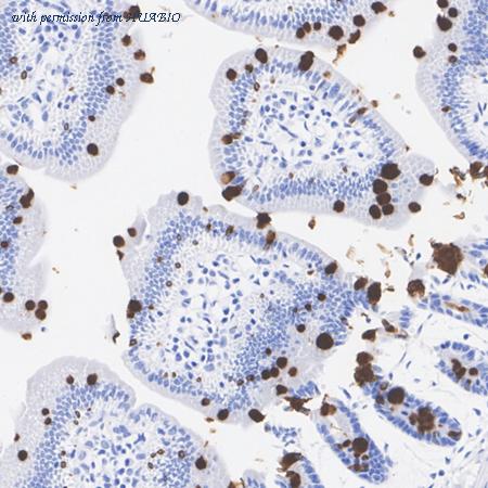 HUABIO ET1704-06-50UL image 3