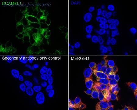 HUABIO ET1704-10 image 2