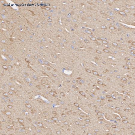 HUABIO ET1704-10 image 3