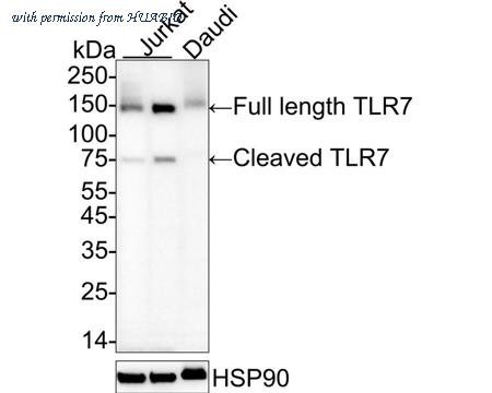 HUABIO ET1704-11 image 1