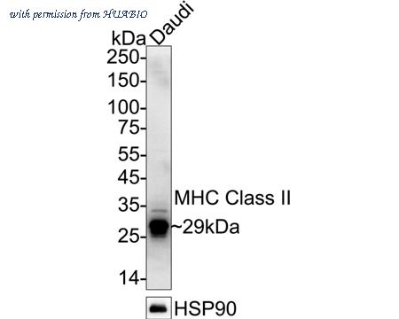 HUABIO ET1704-13 image 1