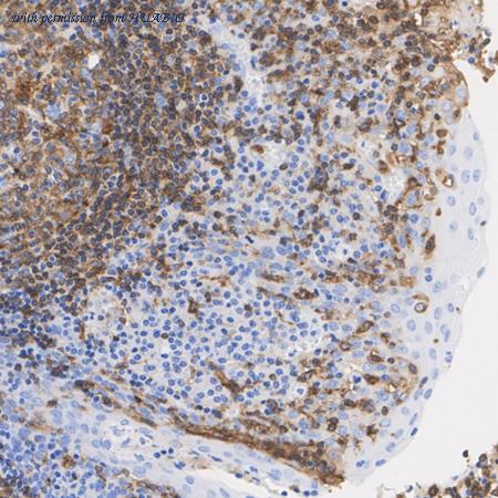 HUABIO ET1704-13 image 2