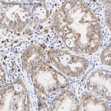 HUABIO ET1704-13 image 3