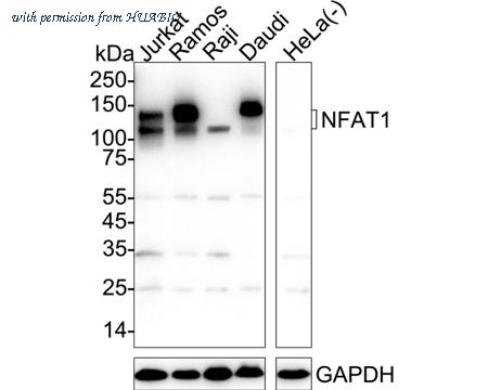 HUABIO ET1704-14 image 1