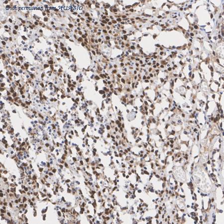 HUABIO ET1704-14 image 3