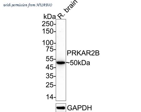 HUABIO ET1704-15 image 1