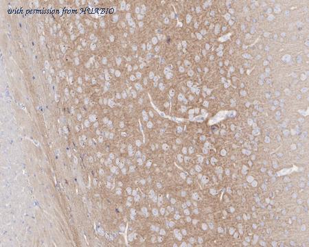 HUABIO ET1704-15 image 2