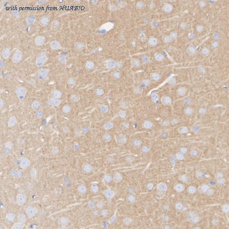 HUABIO ET1704-15 image 3