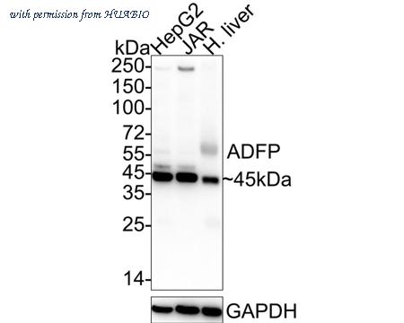 HUABIO ET1704-17 image 1