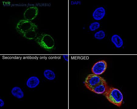 HUABIO ET1704-18 image 3