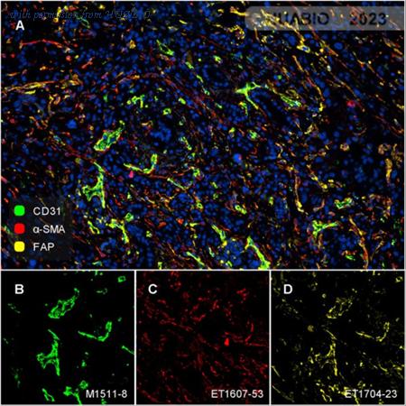 HUABIO ET1704-23-50UL image 2