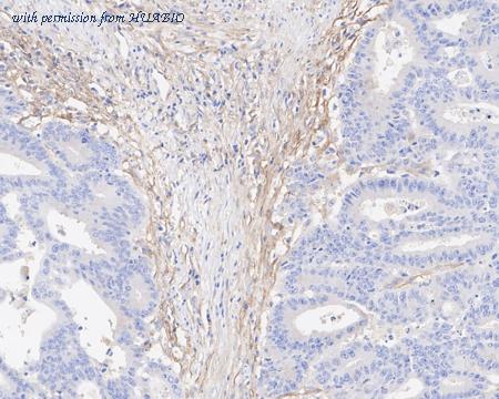 HUABIO ET1704-23-50UL image 3