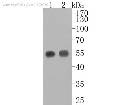 HUABIO ET1704-25 image 2