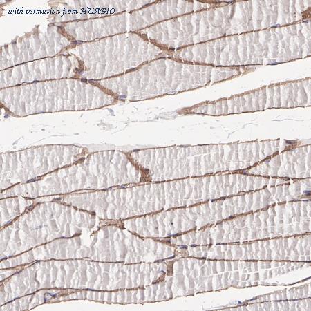 HUABIO ET1704-25 image 3