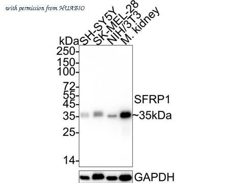 HUABIO ET1704-29 image 1