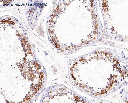 HUABIO ET1704-29 image 2