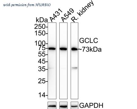 HUABIO ET1704-38 image 1
