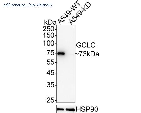 HUABIO ET1704-38 image 2