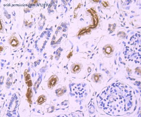 HUABIO ET1704-38 image 3