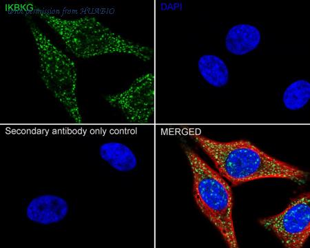 HUABIO ET1704-40 image 3