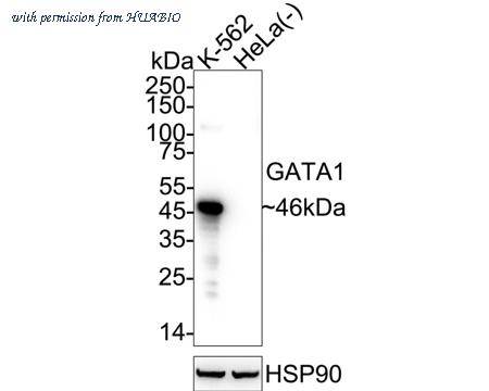 HUABIO ET1704-41 image 1