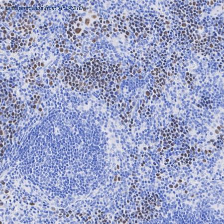 HUABIO ET1704-41 image 2