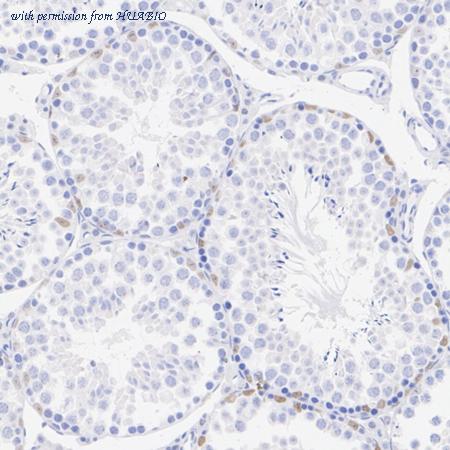 HUABIO ET1704-41 image 3