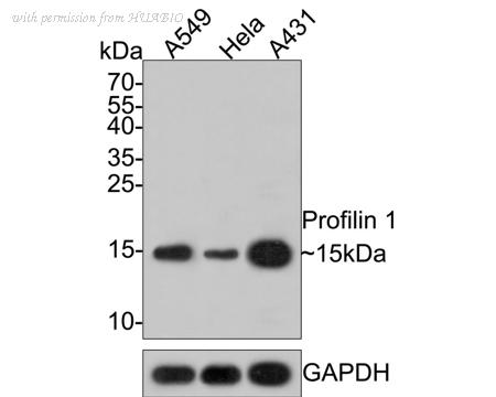 HUABIO ET1704-42 image 1