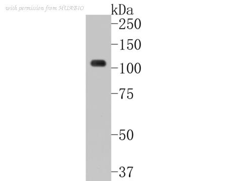 HUABIO ET1704-45 image 1