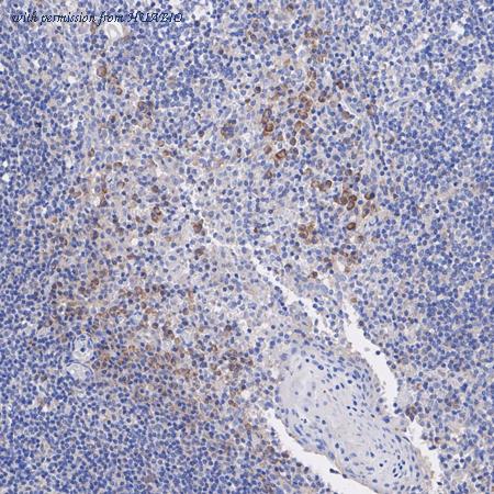 HUABIO ET1704-45 image 2