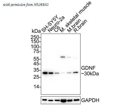 HUABIO ET1704-46 image 1