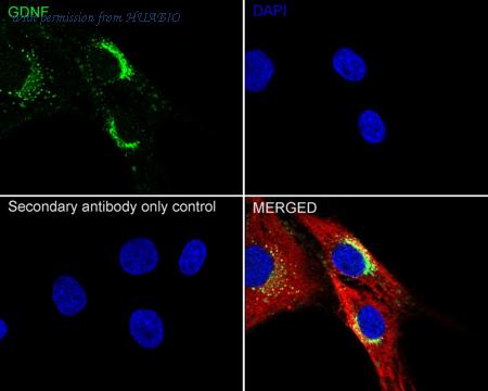 HUABIO ET1704-46 image 2
