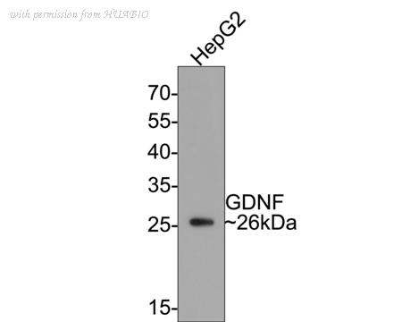 HUABIO ET1704-46 image 3