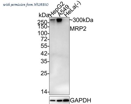 HUABIO ET1704-47 image 1