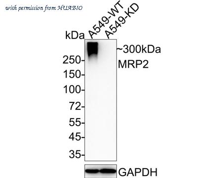 HUABIO ET1704-47 image 2