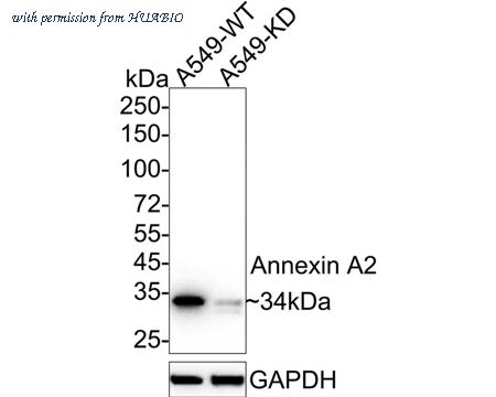 HUABIO ET1704-49 image 1