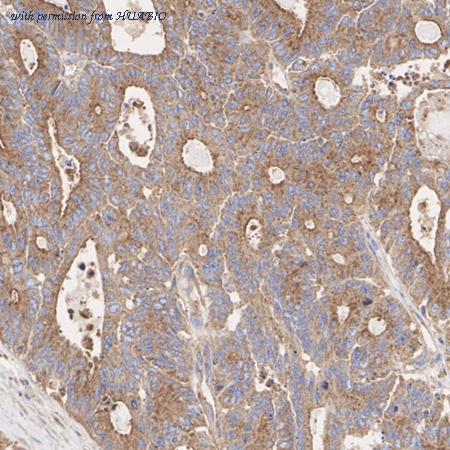 HUABIO ET1704-50 image 2