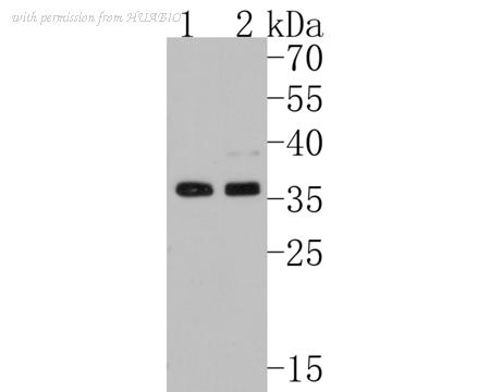 HUABIO ET1704-52 image 1