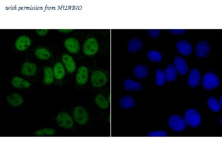 HUABIO ET1704-52 image 2