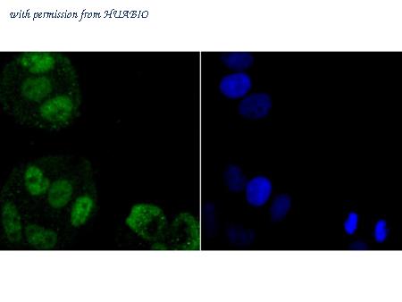 HUABIO ET1704-52 image 3
