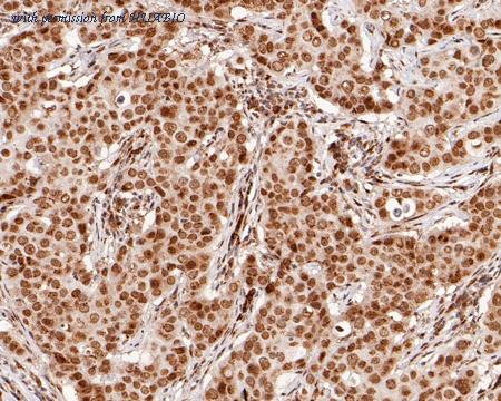 HUABIO ET1704-53 image 3