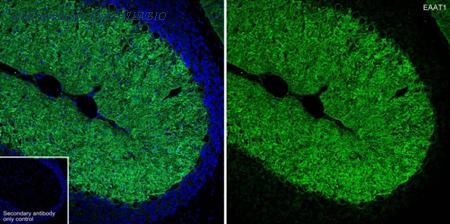 HUABIO ET1704-54 image 2
