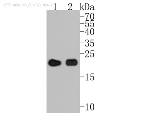 HUABIO ET1704-60 image 3