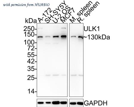 HUABIO ET1704-63-50UL image 1