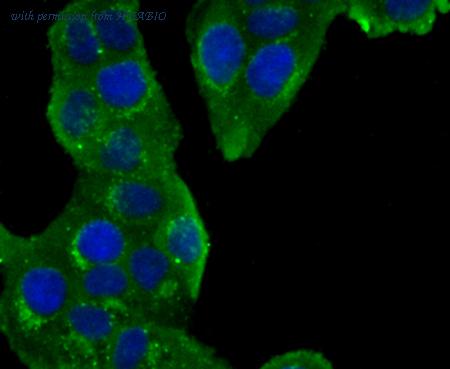 HUABIO ET1704-64 image 3