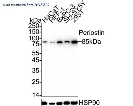 HUABIO ET1704-65 image 1